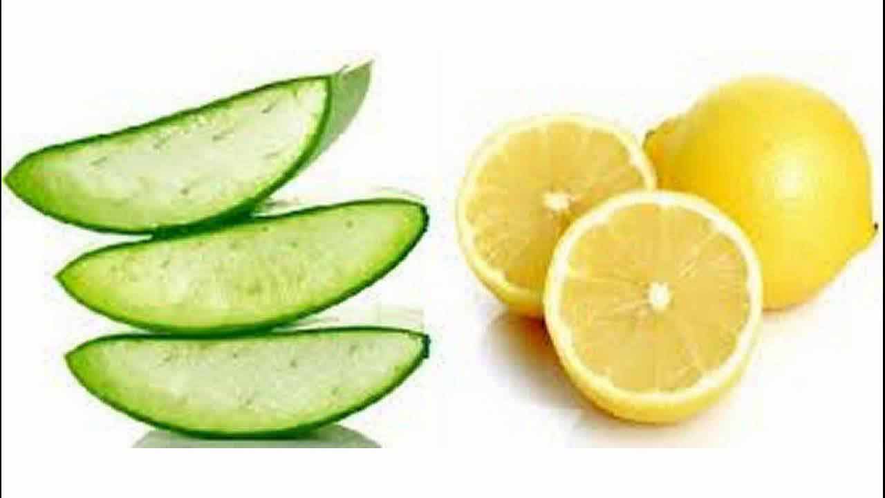 Pakistani home remedies for acne with Aloe vera gel and lemon