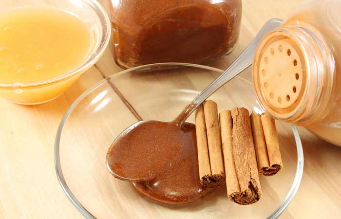 Pakistani home remedies for acne by cinnamon and honey paste