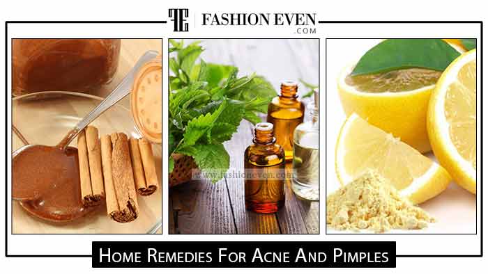 Pakistani home remedies for acne scars and pimples